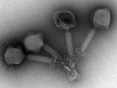 Ein virulenter Listeria-Bakteriophage aus der Familie der Myoviridae. Gut erkennbar ist der kontraktile Schwanz, durch welchen die DNA in die infizierte Bakterienzelle eingeschleust wird.  (Bild: Rudi Lurz, MPI Berlin; Jochen Klumpp und Martin Loessner, ETH Zürich).