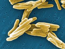 Mycobacterium tuberculosis: ETH-Forscher entdeckten einen Weg, der die Tuberkulose-Erreger empfindlicher auf ein bestimmtes Antibiotikum machen könnte (Bild: http://phil.cdc.gov)