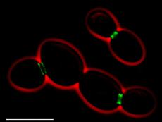 Hefezellen bei der Knospung: Grün fluoreszierend erscheint das Protein Septin, das an der Bildung einer Barriere zwischen Mutter- und Tochterzelle beteiligt ist. (Bild: Philippsen Lab, Biozentrum Basel)