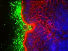«Rauschende» Salmonellen im Mausdarm: Die Bakterien sind grün, die Zellkerne der Mauszellen blau; rot ist der Aktin-Bürstensaum des Dünndarms. (Bildrechte: B. Stecher/W.-D. Hardt / ETH Zürich)