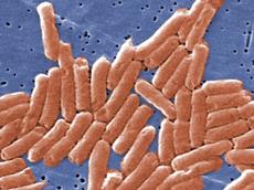 Eine Computersimulation des Immunsystems zeigt, dass ein konstanter Zufluss von Krankheitserregern - im Bild Salmonellen - die Gesundheit des Organismus' stützen kann. (Bild: PHIL)