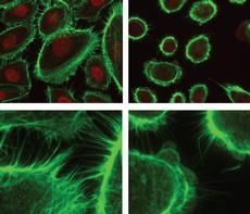 Hautzellen, die über genügend SRF verfügen, haben zahlreiche Kontakte mit Nachbarzellen (Bilder links o. und u.). Zellen, denen es an diesem Faktor mangelt, verinseln und bilden kaum mehr Kontakte. (Bild: Gruppe Prof. S. Werner/ETH Zürich)