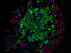 Langerhans-Insel der Bauchspeicheldrüse: Die grün eingefärbten Betazellen und die roten Alphazellen sind Gegenspieler, für deren Gleichgewicht Micro-RNA sorgt. (Bild: wikipedia/masur)