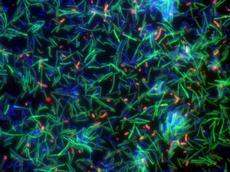 Analyse der Darmbakterien: Eubakterien leuchten grün, Lactobacillus reutteri erscheint rot, die übrigen Bakterien blau. (Bild: B. Stecher /ETH Zürich)