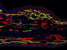 The immunofluorescence image shows lymphatic vessels (yellow), blood vessels (red) and cell nuclei (blue) in the skin of a transgenic mouse, 28 days after inducing chronic inflammation. (Photo: R. Huggenberger, Institute of Pharmaceutical Sciences).