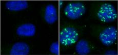 In Zellen mit intaktem Mms22L-Protein ist die DNS im Zellkern (blau) vor Schäden geschützt (linkes Bild). Fehlt dagegen Mms22L, sammeln sich Fehler an, die hier mit Hilfe eines grünen Farbstoffs sichtbar gemacht wurden (rechts). (Bild: zVg Matthias Peter / ETH Zürich)