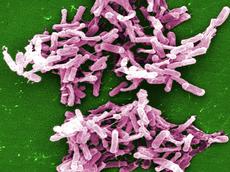Das Bakterium Clostridium difficile sondert ein Toxin ab, das Darmzellen schwer schädigt. (Bild: Janice Carr / CDC)