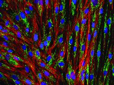Aus Hautzellen wie diesen hat der Japaner Shinya Yamanaka Stammzellen gewonnen, die sich in beliebige Gewebearten entwickeln können (mikroskopische Aufnahme). (Bild: Flickr / GE Healthcare)
