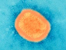 The vaccinia virus uses the garbage system of the cell for its own reproduction. (Image: Sanofi Pasteur / flickr.com)