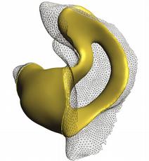 Technologie von ETH-Professorin Olga Sorkine eröffnet dem Hörgerätehersteller Phonak neue Wege bei der Modellierung massgefertigter Produkte: Ohrpassstücke (gelb) können interaktiv am Bildschirm bearbeitet und an den Gehörgang (schwarzes Dreiecksgitter) angepasst werden. (Bild: Phonak)