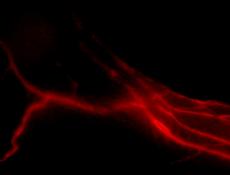 Mit einem bildgebenden Verfahren können ETH-Wissenschaftler Lymphgefässe sichtbar machen, darunter auch neugebildete Gefässe (links im Bild, mikroskopische Aufnahme). (Bild: Steven Proulx et al. / Biomaterials)