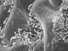 Elektronenmikroskopische Aufnahme einer Blattoberfläche. Auf jedem Quadratzentimeter leben bis zu zehn Millionen Einzeller (Bild: Gerd Innerebner und Roger Wepf/ETH Zürich)