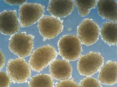 Insphero bietet dreidimensionale Zellkulturen an, hier in Form von 150 Mikrometer grossen Tumor-Mikrogeweben (Bild: Insphero AG)