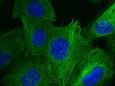 Lungenepithelzellen wie auf dem Foto werden verwendet, um Nanopartikel-Zell-Interaktionen zu untersuchen. Während der letzten 10 Jahre gelang es Schweizer Forschern damit die wissenschaftliche Grundlage für das Vorsorgeraster zu legen. (Bild: Ludwig Limbach/ETH Zürich)