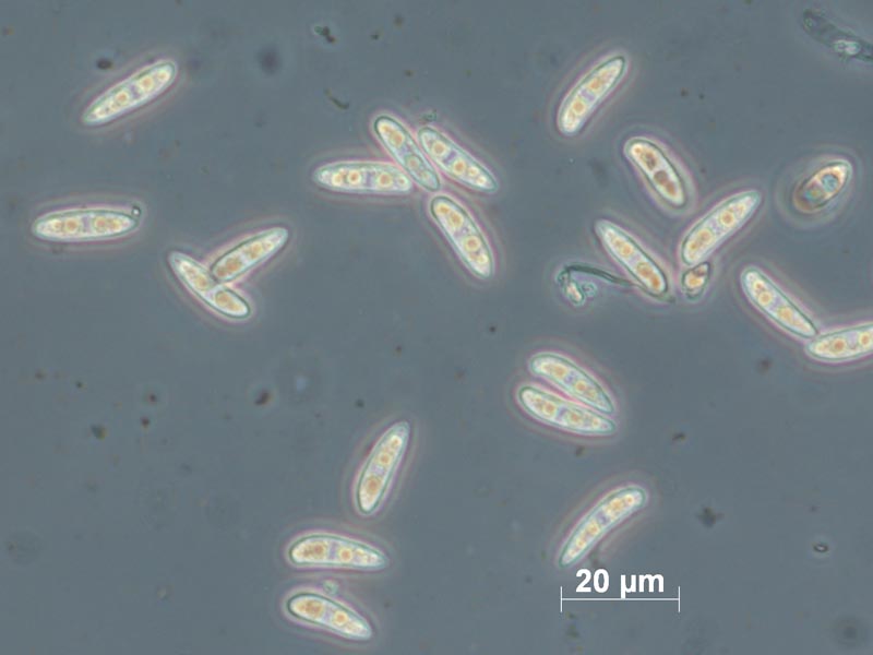 Sporenbehälter von Hymenoscyphus pseudoalbidus sind länger und spitziger als die einer verwandten Pilzart. (Bild: V. Queloz /ETH Zürich)