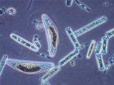 Formenvielfalt unter dem Mikroskop: die Kieselalgen Cymbella, Diatoma vulgare und Navicula (Bild: Eawag)