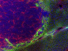 Mikroskopische Aufnahme eines von gesundem Gewebe umgebenen Tumors. Blutgefässe des Tumors sind rot gefärbt, gesundes Gewebe ist grün gefärbt. (Bild: Philochem AG)