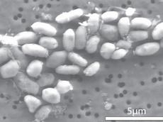 Auf den Spuren von Arsen und Phosphat: Das «Arsen-Bakterium» GFAJ-1 braucht doch Phosphat zum Wachsen. (Bild: Jodi Switzer Blum / NASA)