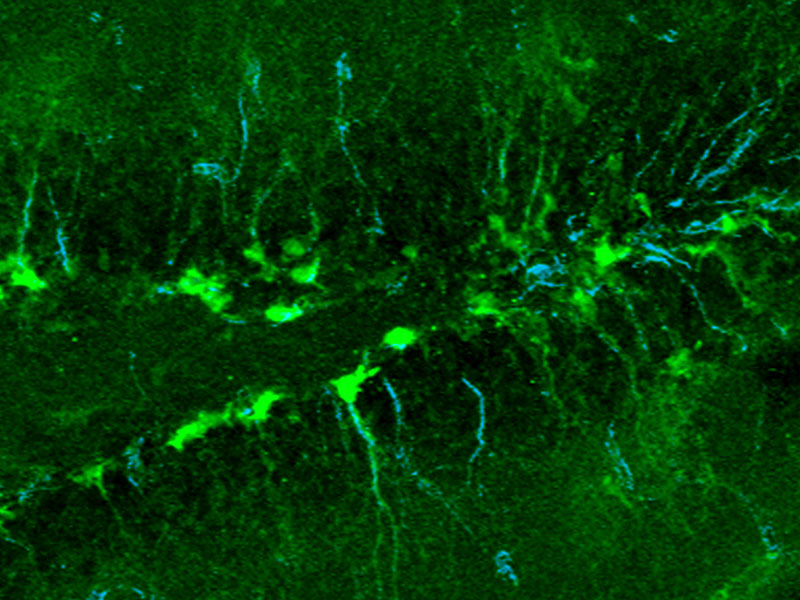 Neurale Stammzellen (grün) im adulten Hippokampus, die das Stammzellprotein Nestin (blau) exprimieren. Dadurch werden die wachsenden Fortsätze sichtbar. (Bild: Marlen Knobloch, HiFo, UZH)