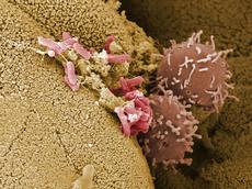 Der Mikroorganismus Salmonella typhimurium (rosa) im Darm einer befallenen Maus (elektronenmikroskopische Aufnahme). (Bild: M. Rohde und K. Dittmar / Helmholtz Zentrum für Infektionsforschung)