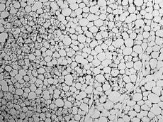 “Brite” fat cells containing many small lipid droplets (seen mostly on the left side of this micrograph) can be found between the larger white fat cells after cold adaptation. (Image: Christian Wolfrum / ETH Zurich)