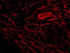 Querschnitt durch ein Leukämie-Geschwür (Chloroma), das aus Mäusen stammt, angefärbt mit Antikörpern, die an ein Angiogenese-Protein (rot) binden. (Bild: Katrin Gutbrodt / ETH Zürich)